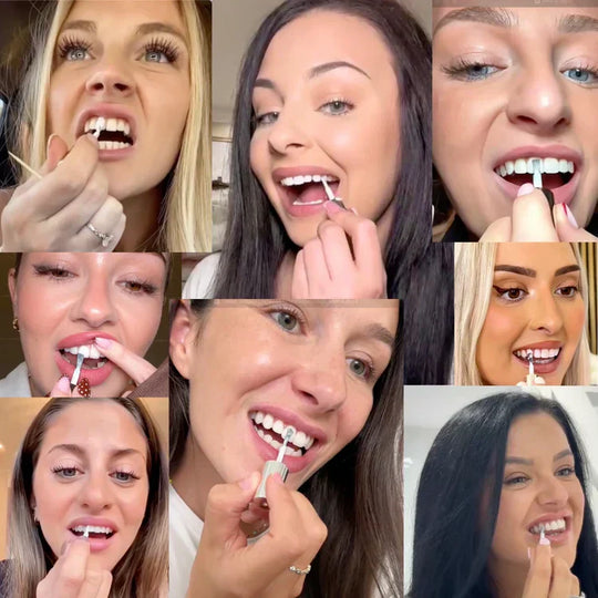Tooth Polish - Instant Clean Smile