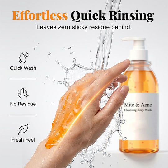 🔥 50% OFF TODAY! 🛁 Anti-Mite &amp; Acne Control Body Wash ✨ Deep Cleansing, Oil Control &amp; Clearer-Looking Skin