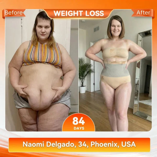 🥳2026 HOT SALE🥳💞80K+ SOLD!🌸🧘‍♀️ 40% OFF! Thermogenic Tummy Control Shorts – 30‑min daily wear, activates warmth &amp; boosts circulation. Supports firmer, smoother contour. No gym needed. A smart shapewear choice. 👵✨
