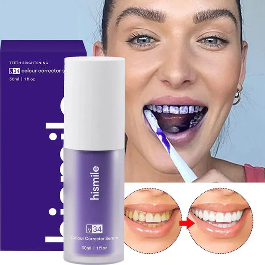 🦷✨ Hismile Teeth Whitening 💎 Gentle Whitening, Fresh Breath &amp; a Brighter-Looking Smile