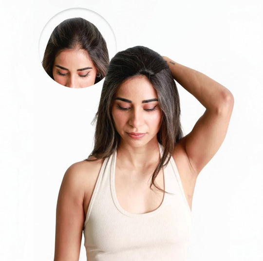 🚨 90% OFF TODAY! 💇‍♀️ INVISI-LIGHT™ Cover-Up Patch ✨ Blends Seamlessly Like Your Real Hair—No Bulky Hairpiece
