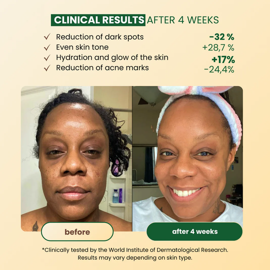 CuraGlow Anti-Spots &amp; Hyperpigmentation Soap