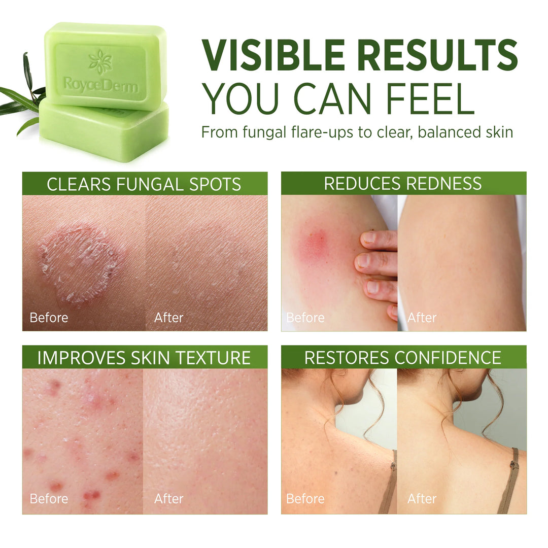 Mýdlo Tea Tree Oil
