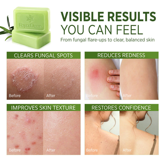 Mýdlo Tea Tree Oil