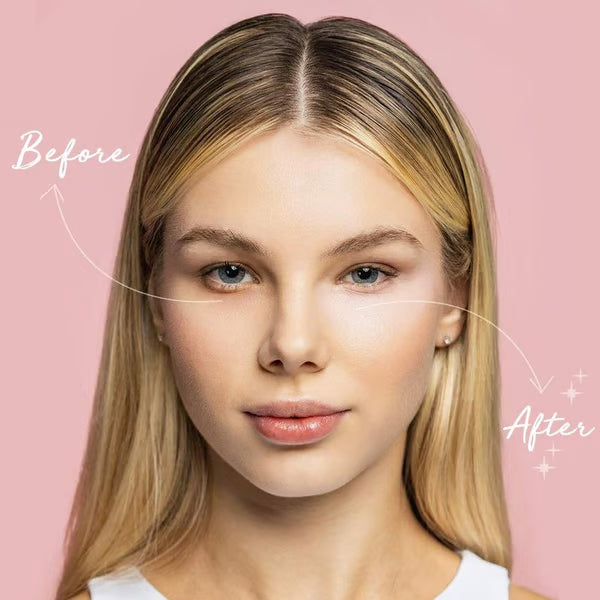 ✨ LAST DAY PROMOTION - BUY 1 GET 1 FREE✨Under Eye Brightener, Conceal &amp; Brighten Dark Circles