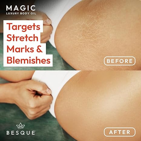 Besque Original Magic Body Oil, 3,4 FL OZ, huile corporelle après douche pour femme, soin hydratant pour tout le corps qui repulpe, raffermit,  &amp;  raffermit la peau avec des ingrédients naturels, cadeaux de spa de luxe - paquet de 1