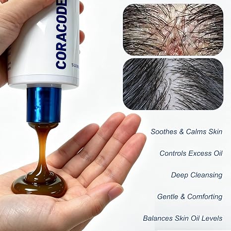Folliculitis Shampoo for Itchy, Flaky Scalp - Purifying Formula for a Soothed, Balanced Scalp &amp; Oily Scalp Care, Men &amp; Women, 10.58 Fl Oz (1)