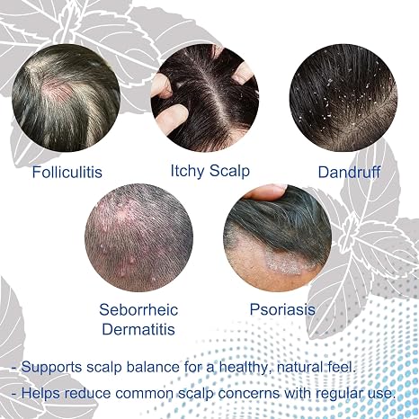 Folliculitis Shampoo for Itchy, Flaky Scalp - Purifying Formula for a Soothed, Balanced Scalp &amp; Oily Scalp Care, Men &amp; Women, 10.58 Fl Oz (1)
