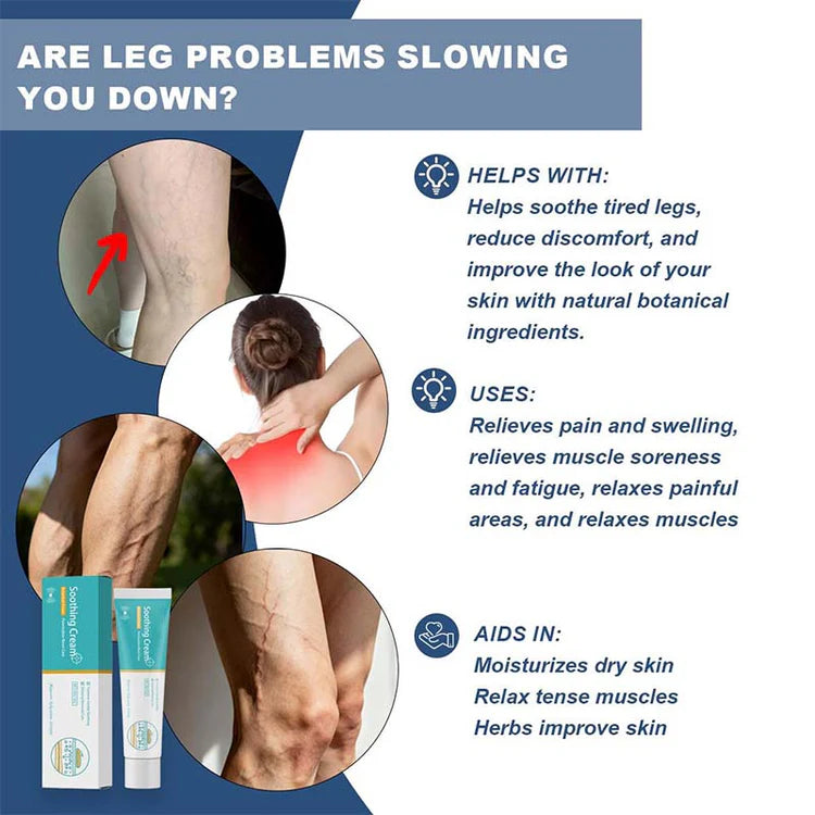 Herbal Varicose Vein Treatment Cream