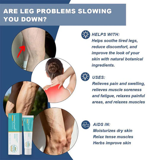 Herbal Varicose Vein Treatment Cream