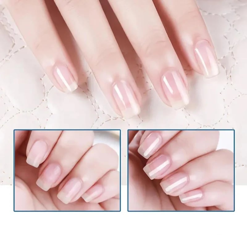 💝💅LAST DAY - BUY 1 GET 1 FREE!!💝3 Days Nail Care - Keratin Amino Acid Formula, Suitable for Soft and Fragile Nails