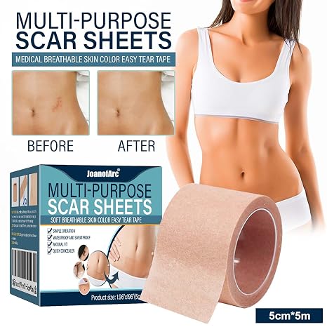 Tattoo cover-up tape, 2" x 16.4&