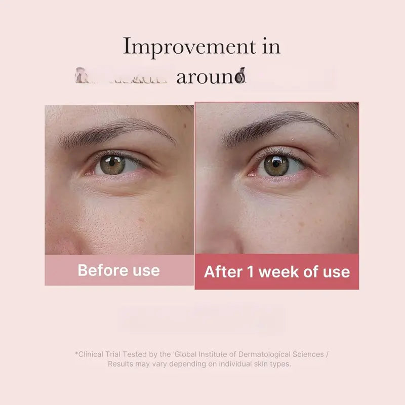medicube Salmon DNA PDRN Pink Peptide Eye Serum with Niacinamide and 99% Purity Retinol for Fine Lines, Uneven Skin Tone, Korean Skin Care 1.01fl.oz