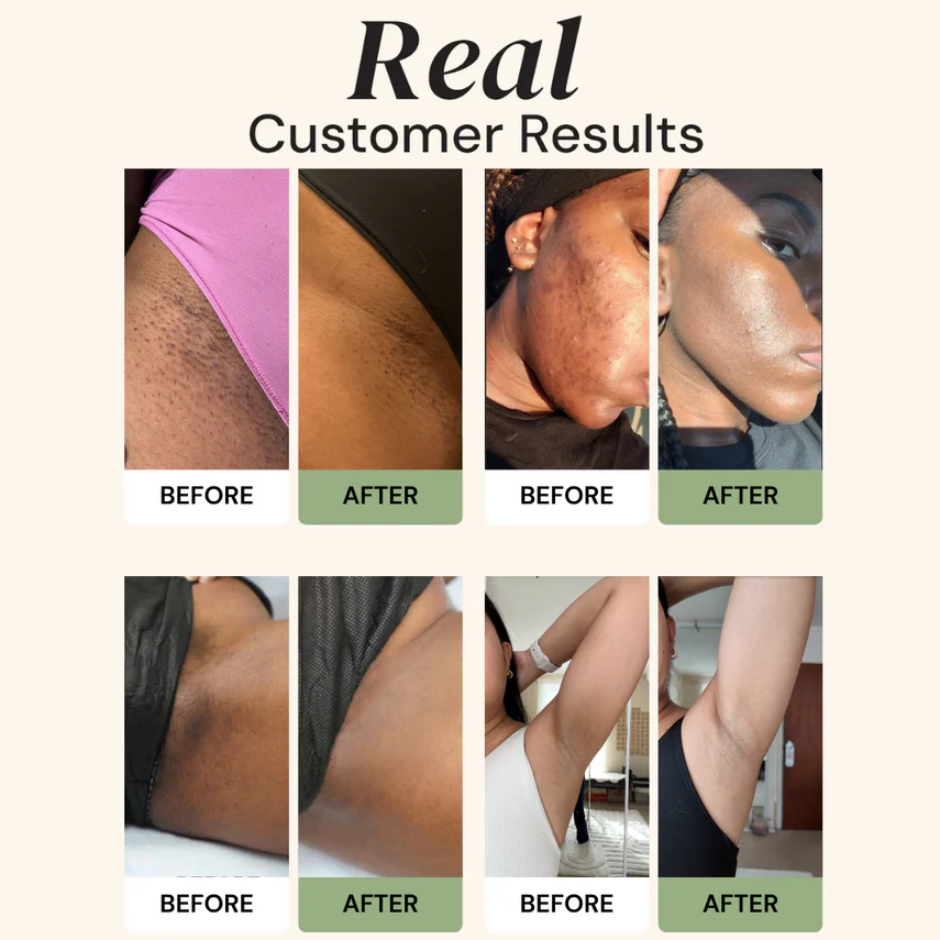 CuraGlow Anti-Spots &amp; Hyperpigmentation Soap
